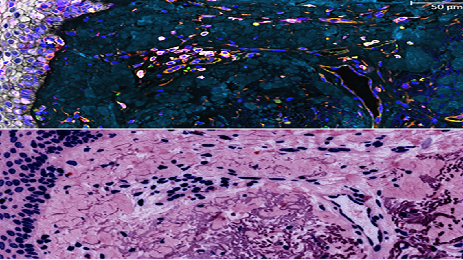 Proteins in the epidermis, the outermost skin layer, courtesy of Dr. Fiona Ginty at GE Research