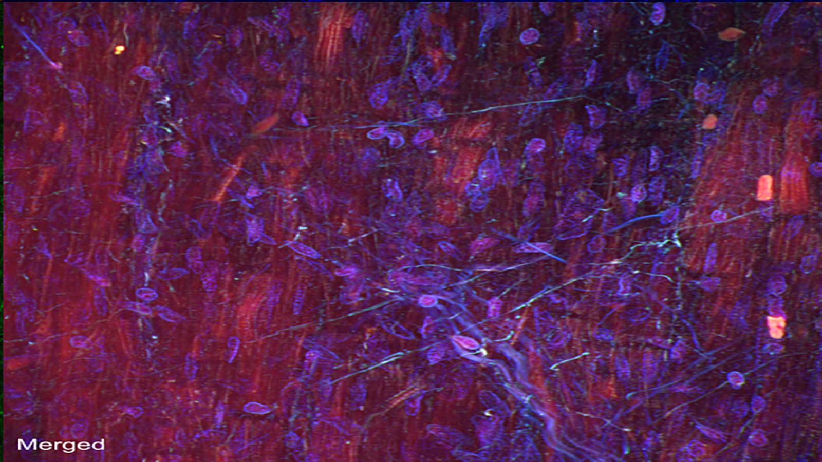 Autofluorescence image capturing heart cells (red), nuclei (blue), and dense fibers of the heart (green), courtesy of Dr. Seth Currlin at University of Florida