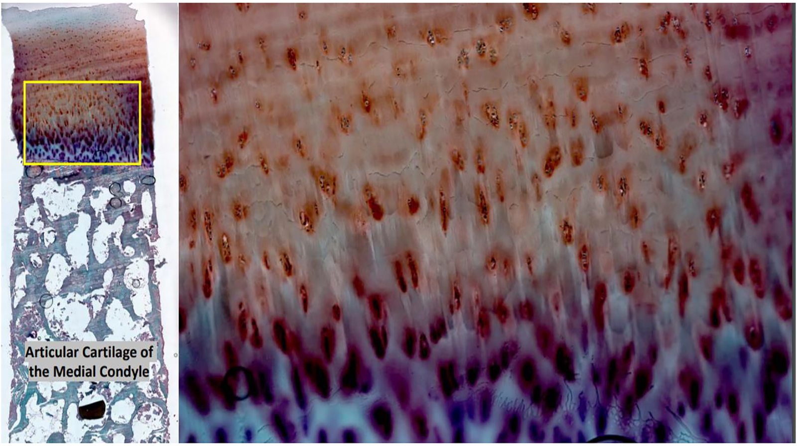 Human cartilage from the knee end of an adult femur stained with Safranin-O, courtesy of Dr. Peter Maye of UConn