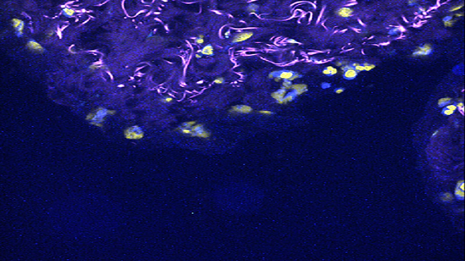 seqFISH image of healthy human small intestine, courtesy of Long Cai's lab at Cal Tech