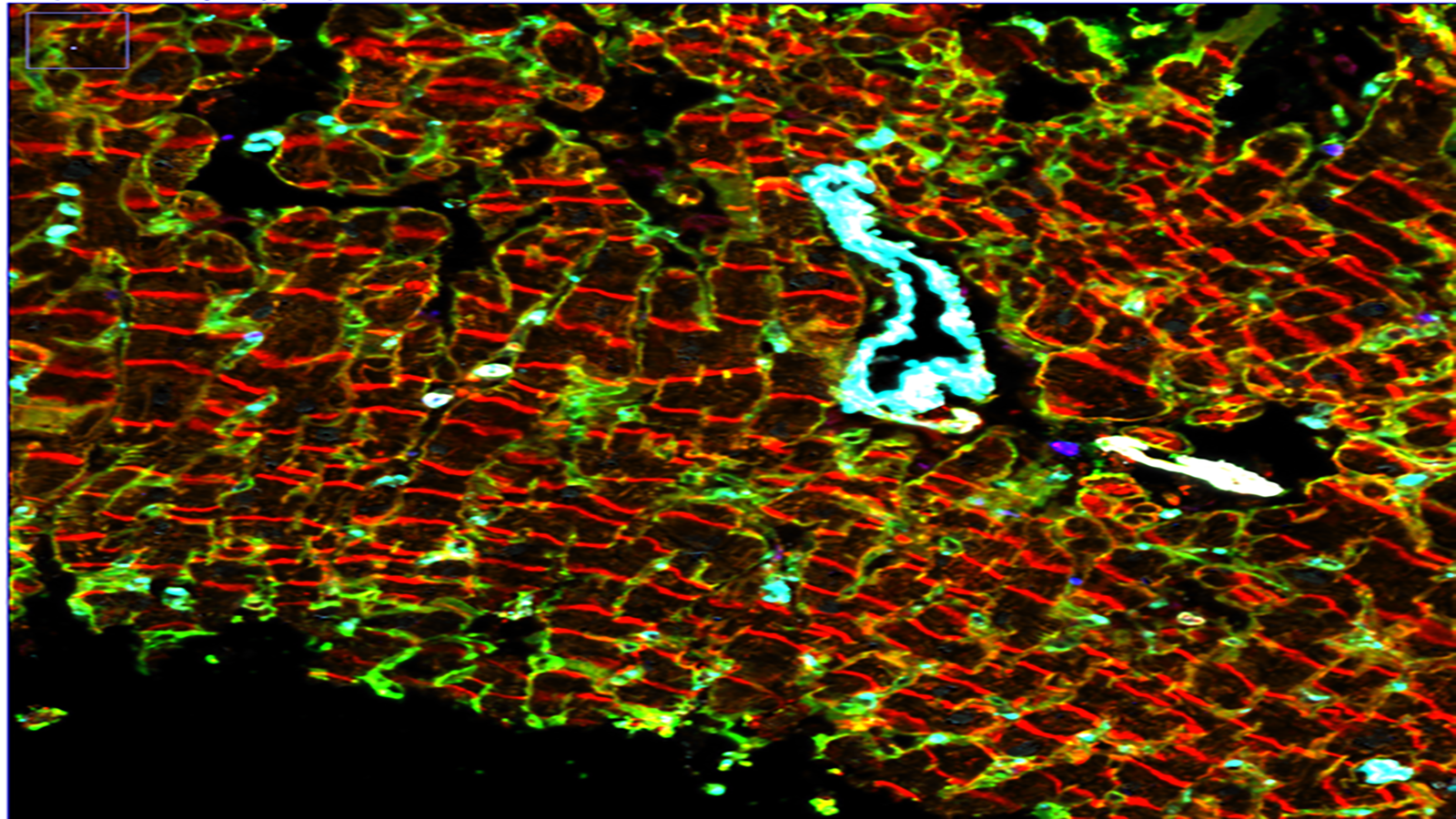 Cell DIVE image of the human heart, courtesy of Liz McDonough of the Ginty lab at GE Research