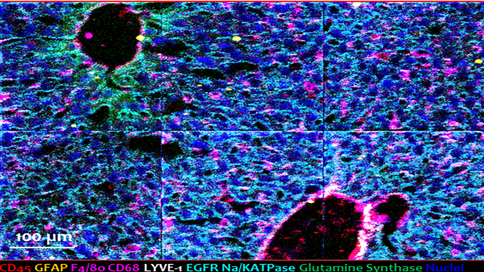 Mass spec image of mouse liver, courtesy of Dr. Hua Tian at Penn State.