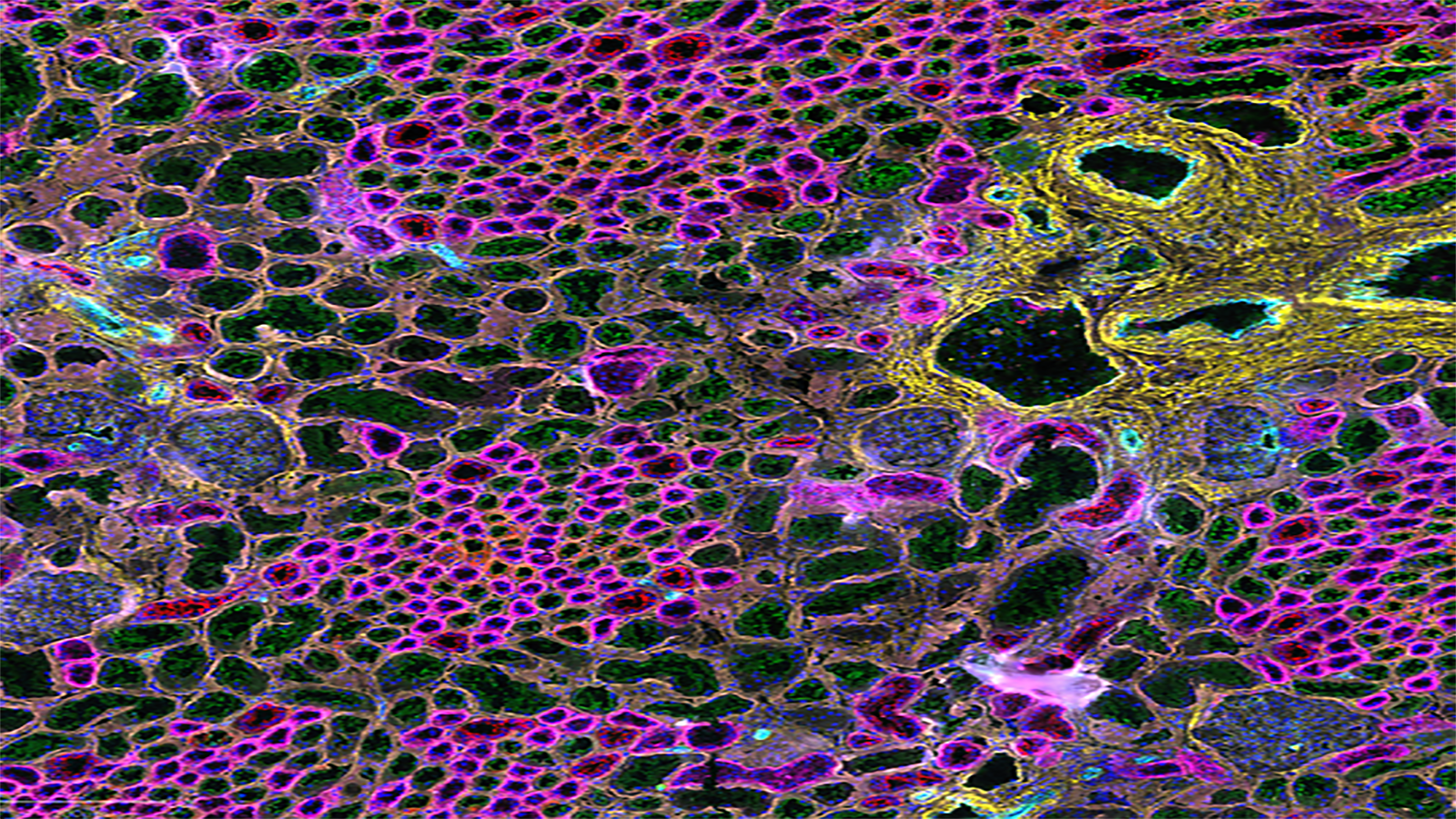 Cell DIVE image of healthy human kidney, courtesy of Christine Surrette and Dr. Elizabeth Neumann from GE Research and Vanderbilt (respectively)