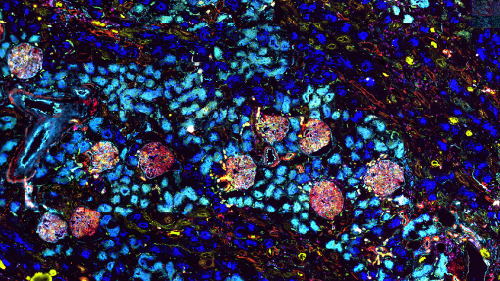 codex MIF image from HuBMAP member, Dr. Elizabeth Neuman, showing the cortex from a human kidney using 19 antibodies.