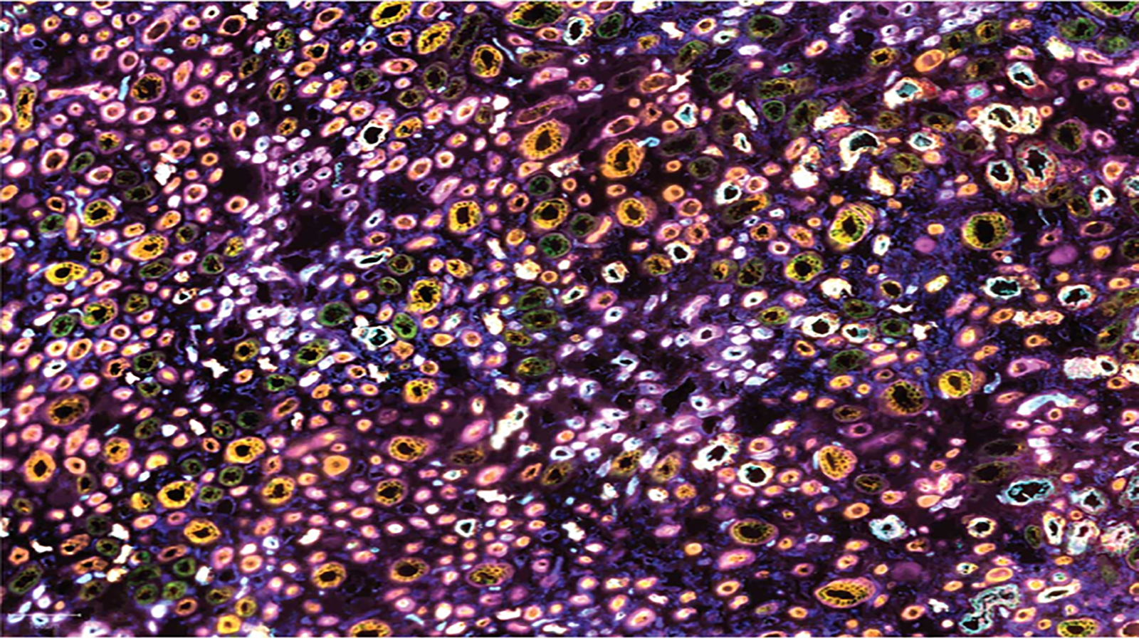 CODEX image of human kidney medulla, from Dr. Elizabeth Neumann at Vanderbilt
