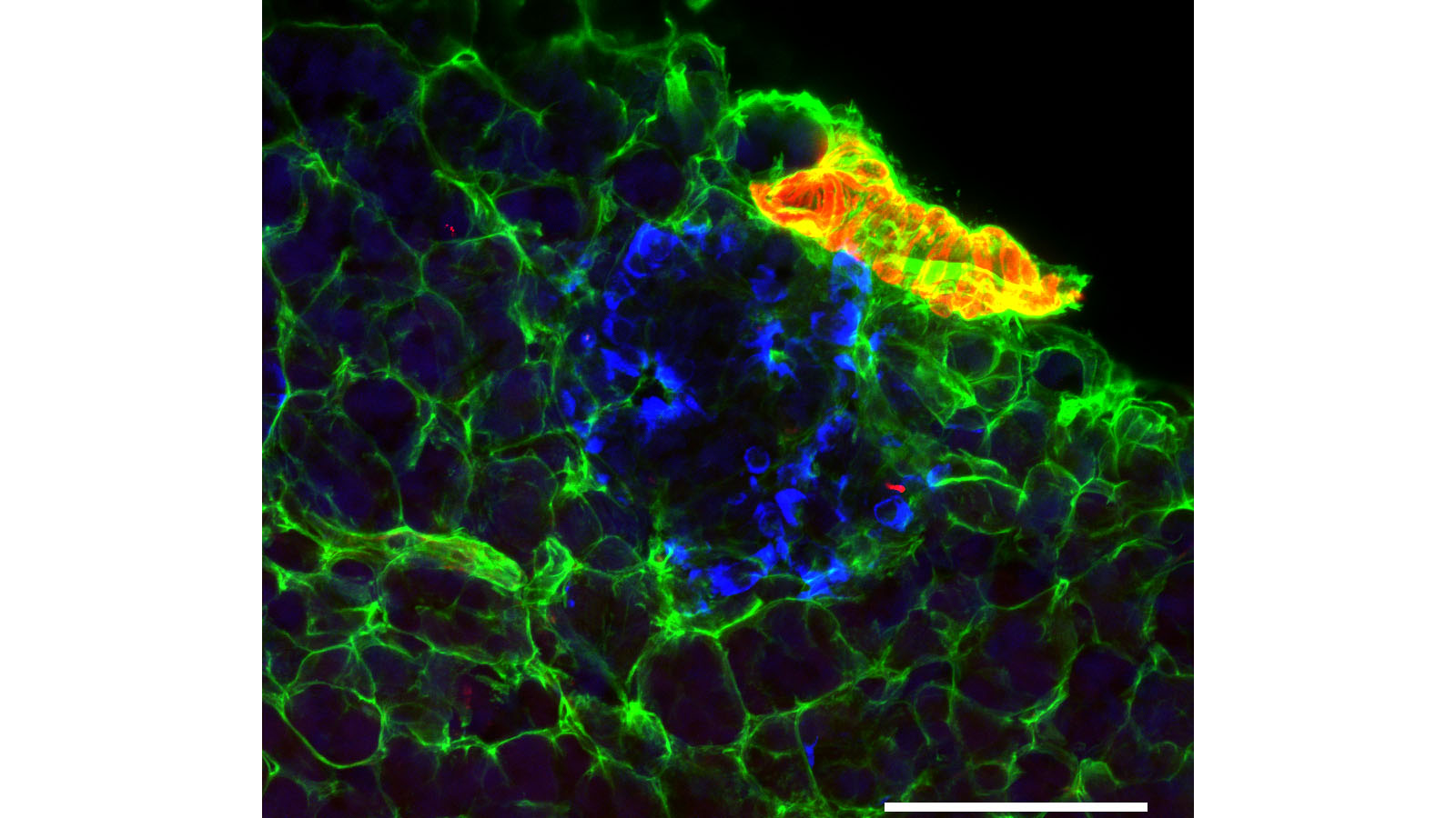 Lightsheet microscopy image of heathy human pancreas, from Katelyn Carty at the University of Florida
