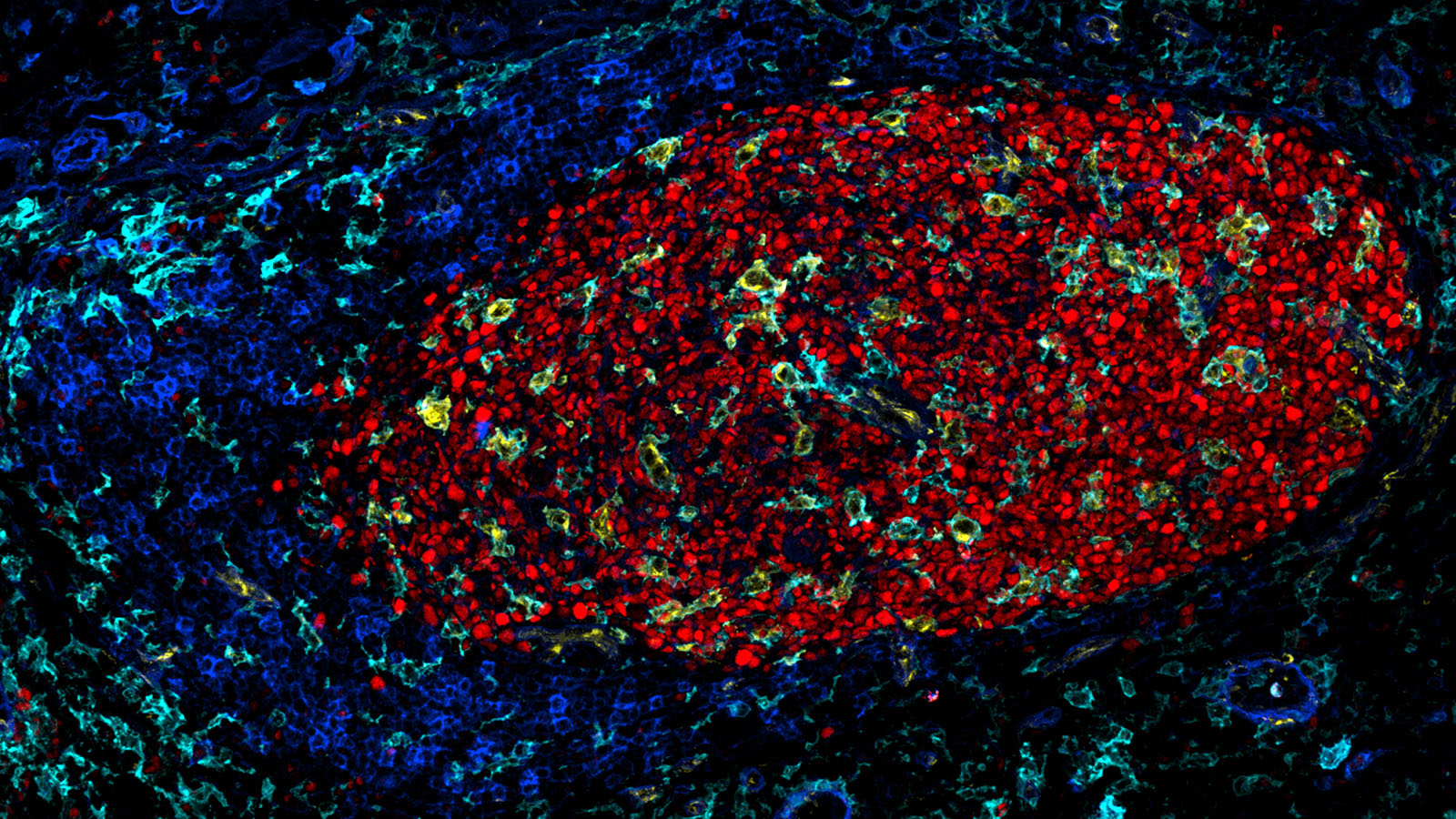 IBEX image of germinal center of human lymph nodes, courtesy of Dr. Andrea Radtke of the Germain Lab at NIAID