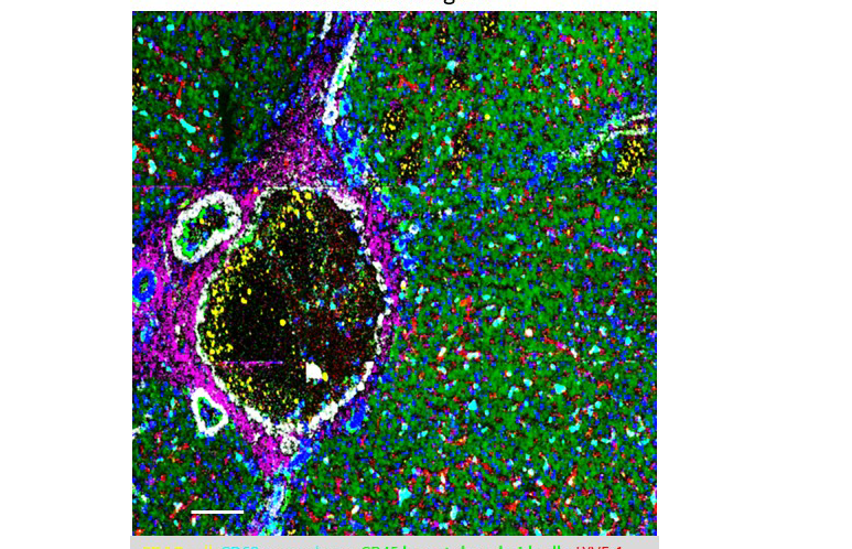 Mass spec image of the portal triad in human kidney, courtesy of Dr. Hua Tian from Penn State