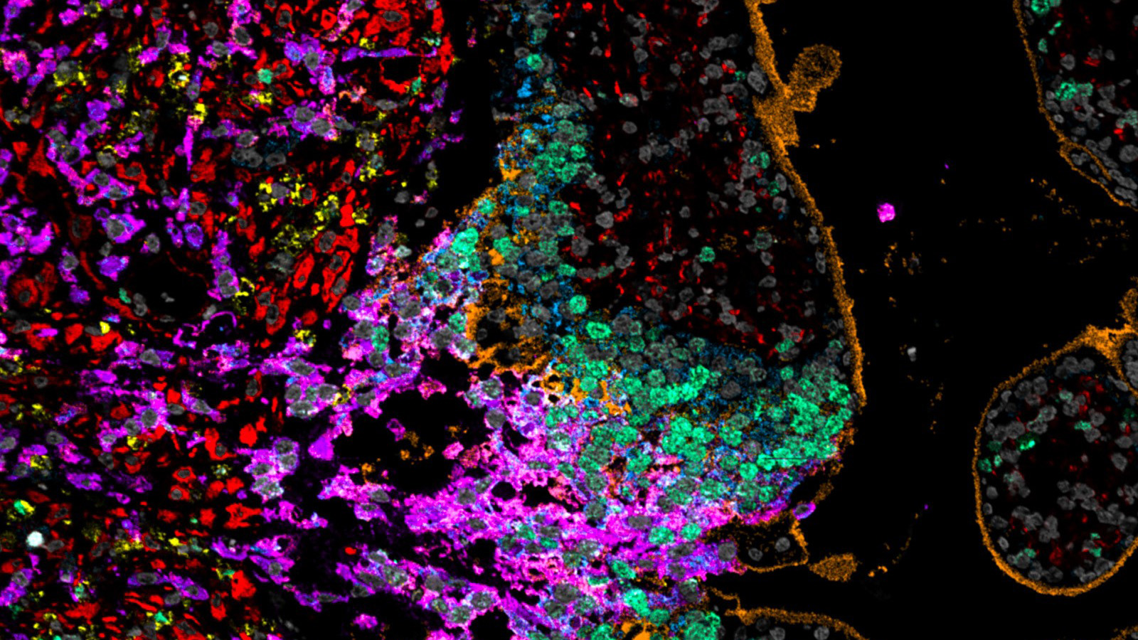 MIBITOF image of decidua, courtesy of Mike Angelo lab at Stanford University