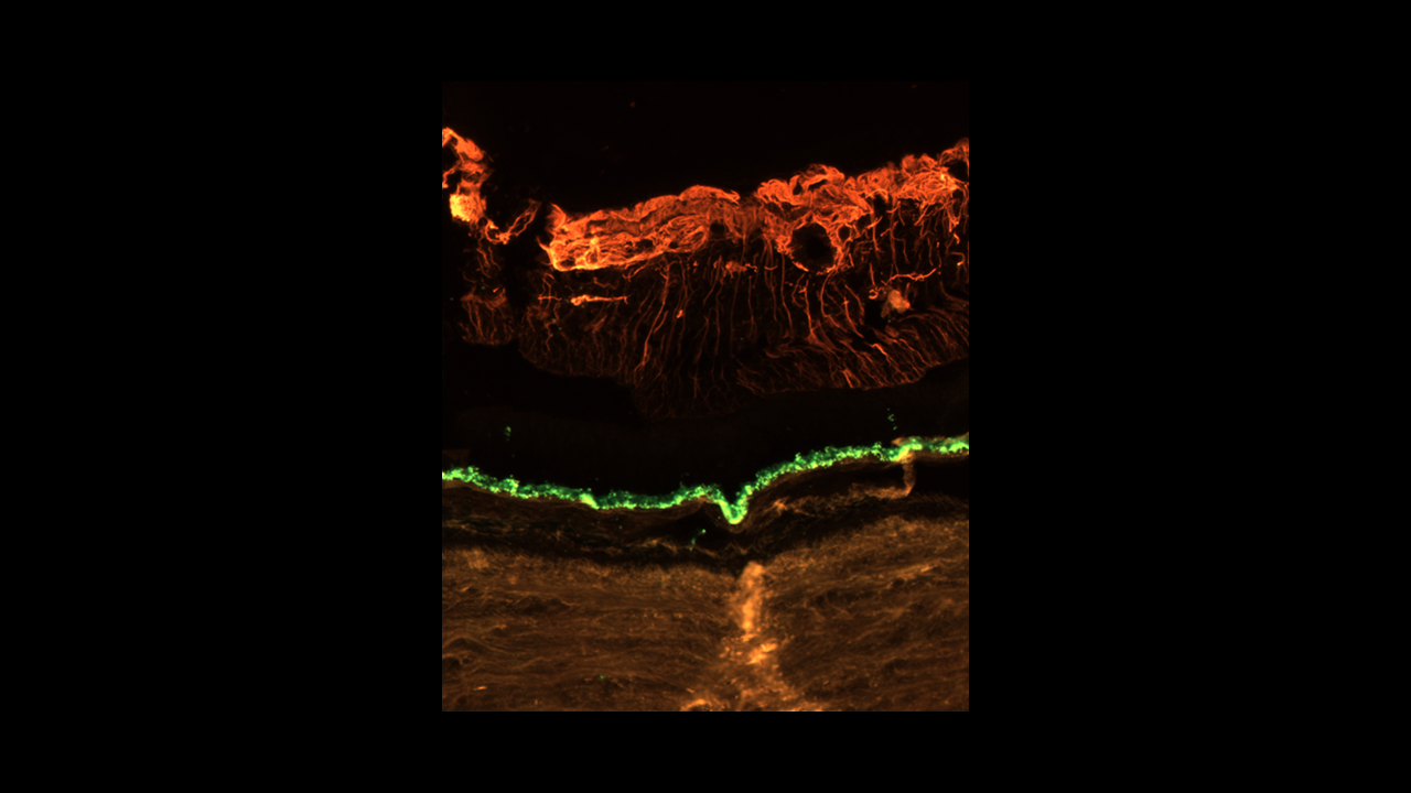 Immunofluoscence microscopy image of a human retina courtesy of Dr. Angela Kruse of Vanderbilt University