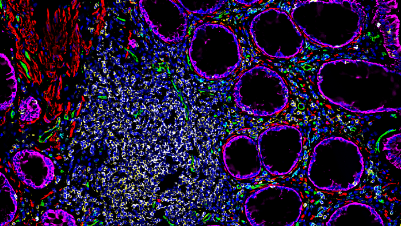 7 proteins in a section of healthy human colon tissue, courtesy of Dr. John Hickey at Stanford