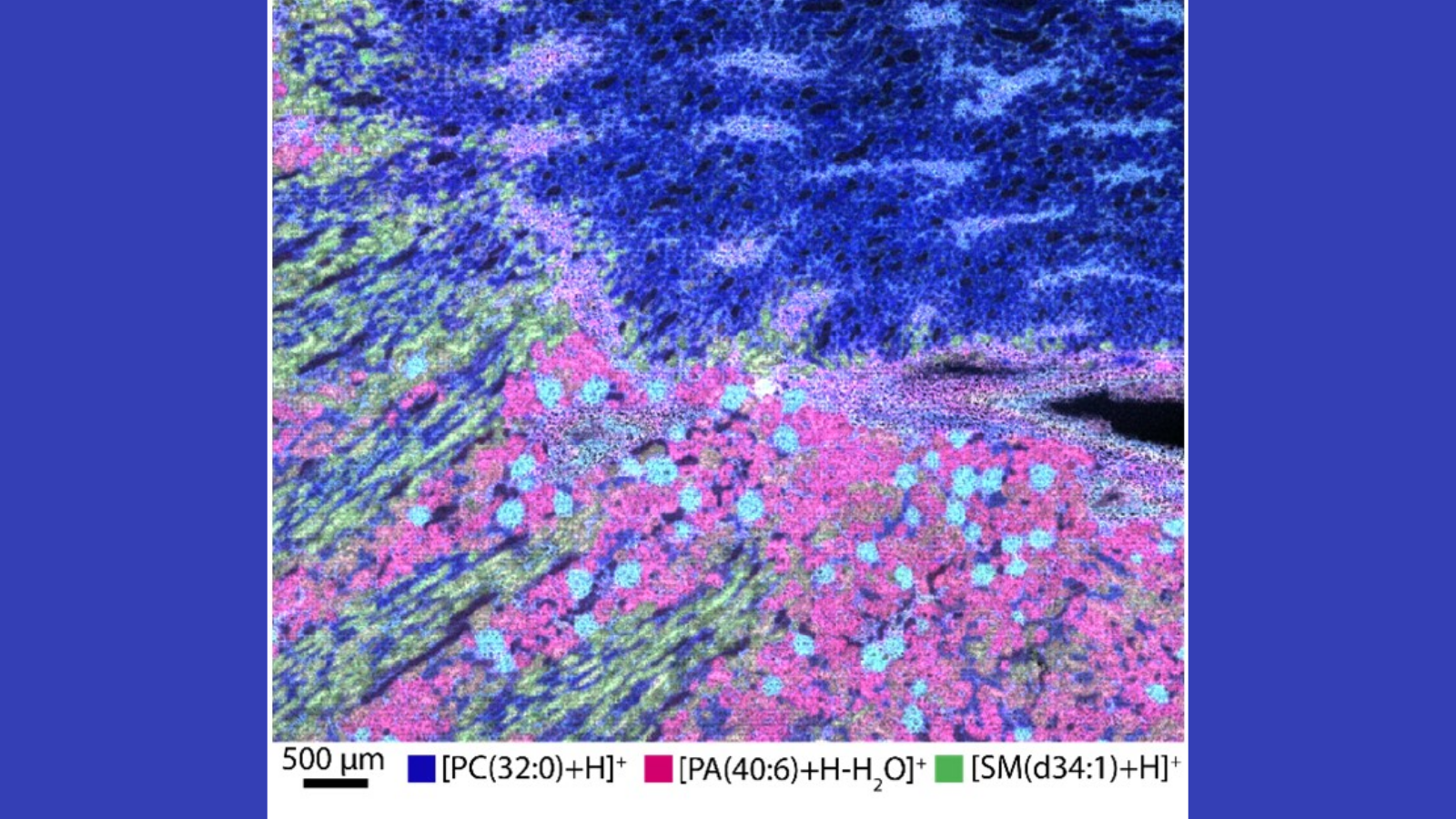 MALDI mass spectrometry image that shows where three kinds of lipids are in different parts of a human male kidney, courtesy of Dr. Elizabeth Neuman of Vanderbilt