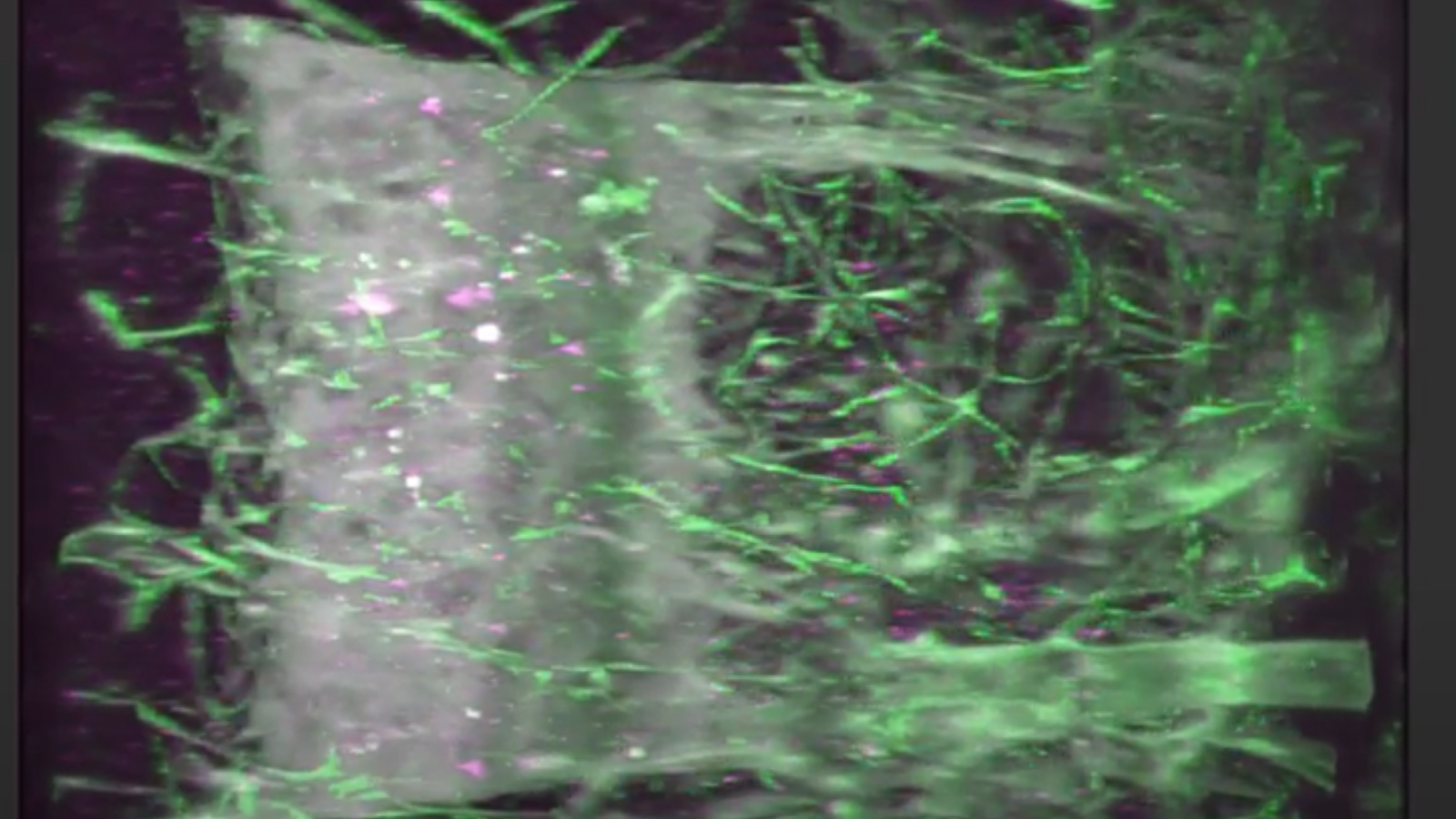 lightsheet image from University of Florida's, Seth Currlin, showing the neural network (green) within a human thymus, where the cells that fight infection mature.