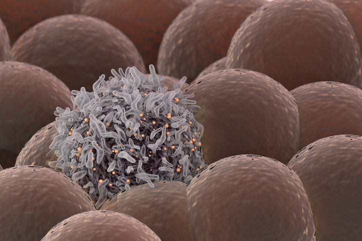 cancer cell among healthy cells