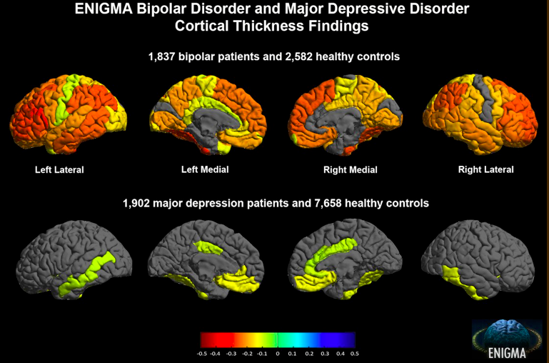 ENIGMA bipolar disorder and major depressive disorder cortical thickness findings
