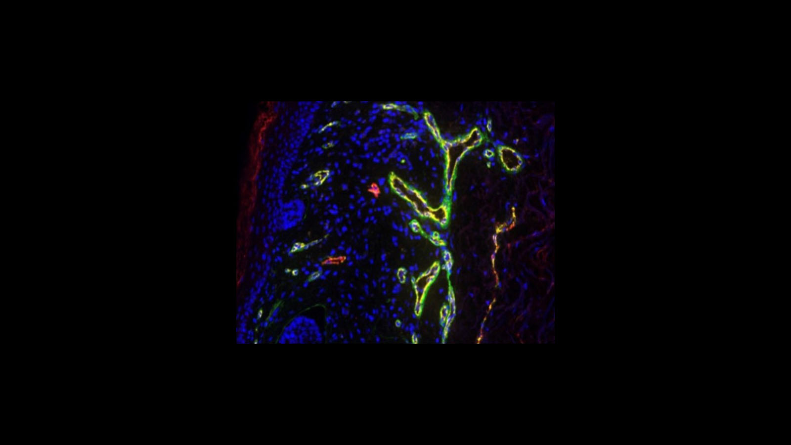 Cell DIVE multiplexed immunofluorescent image of skin courtesy of Dr. Fiona Ginty, Chrystal Chadwick, and Liz McDonough at GE Research