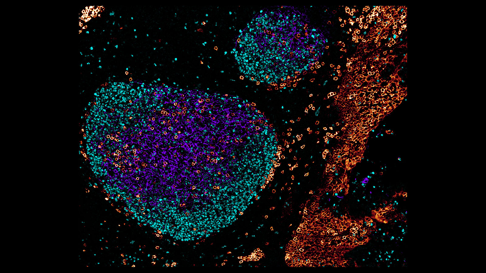 Confocal microscopy image of a human tonsil by Dr. Andrea Radtke in the Germain lab at NIAID