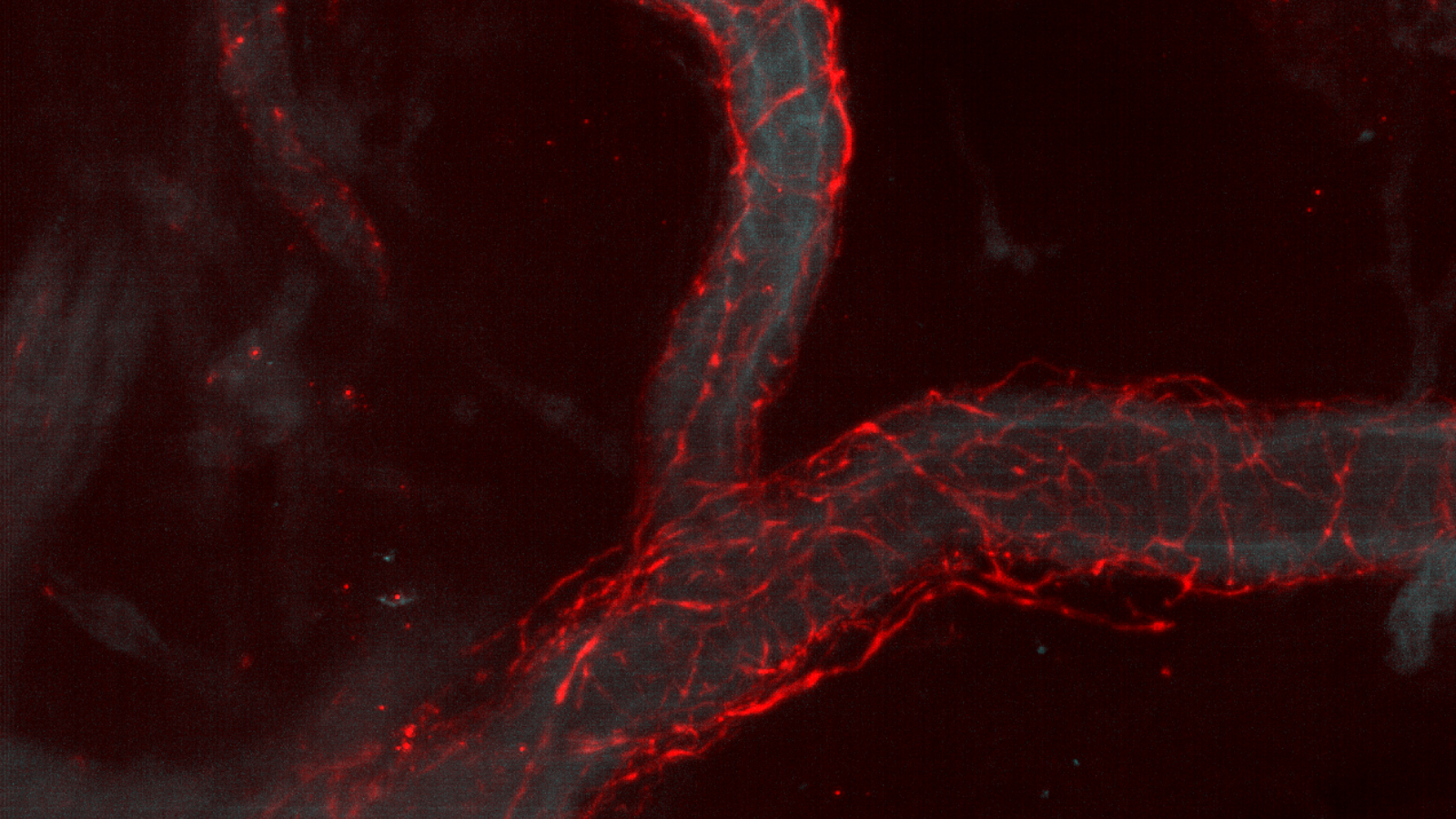 A human splenic blood vessel (cyan) surrounded by the tyrosine hydroxylase matrix (red) from axons near the blood vessel, courtesy of Dr. Seth Currlin, University of Florida