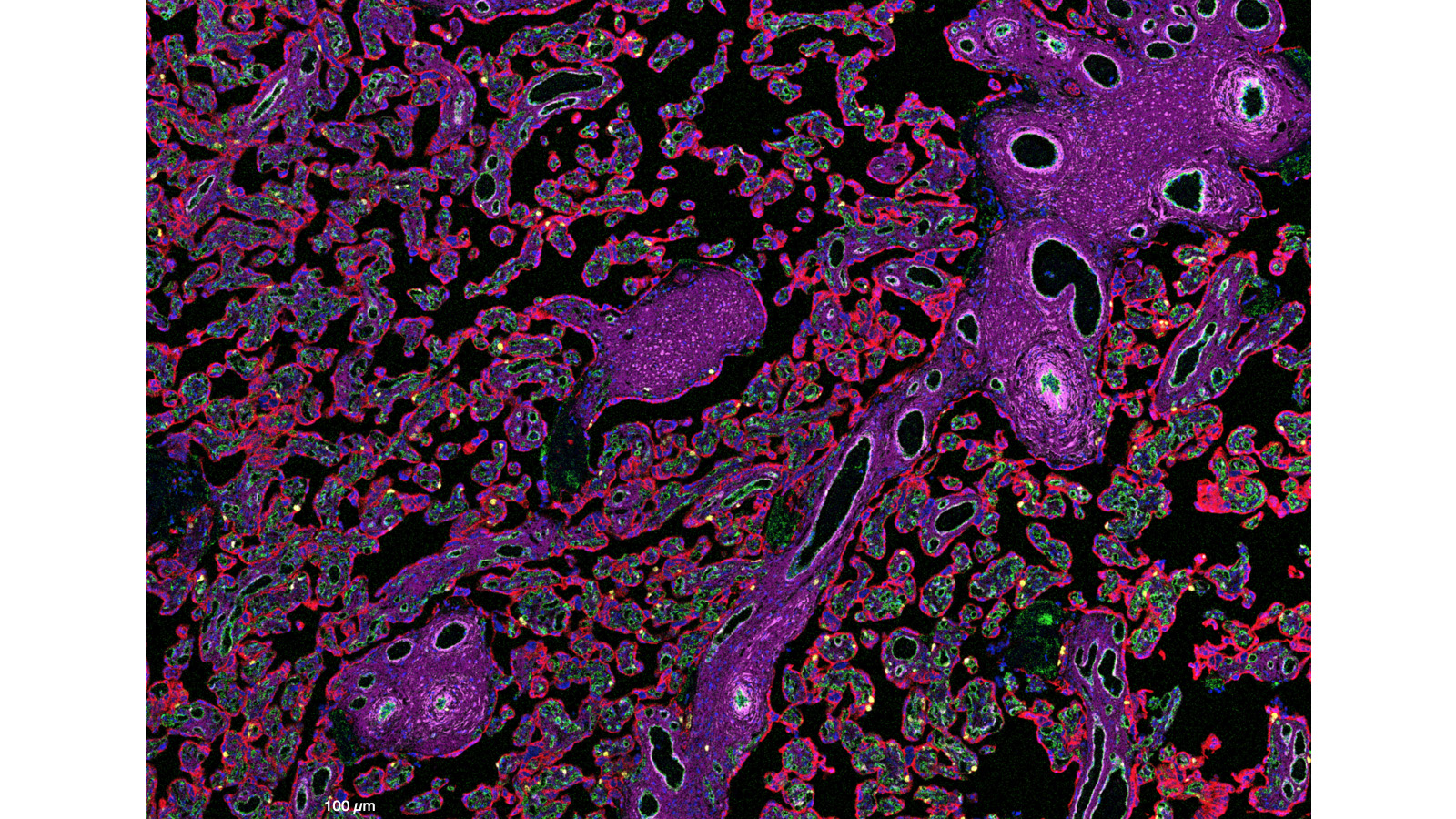 Imaging mass cytometry image of the placenta, courtesy of Santhosh Sivajothi of the Robson lab at JAX