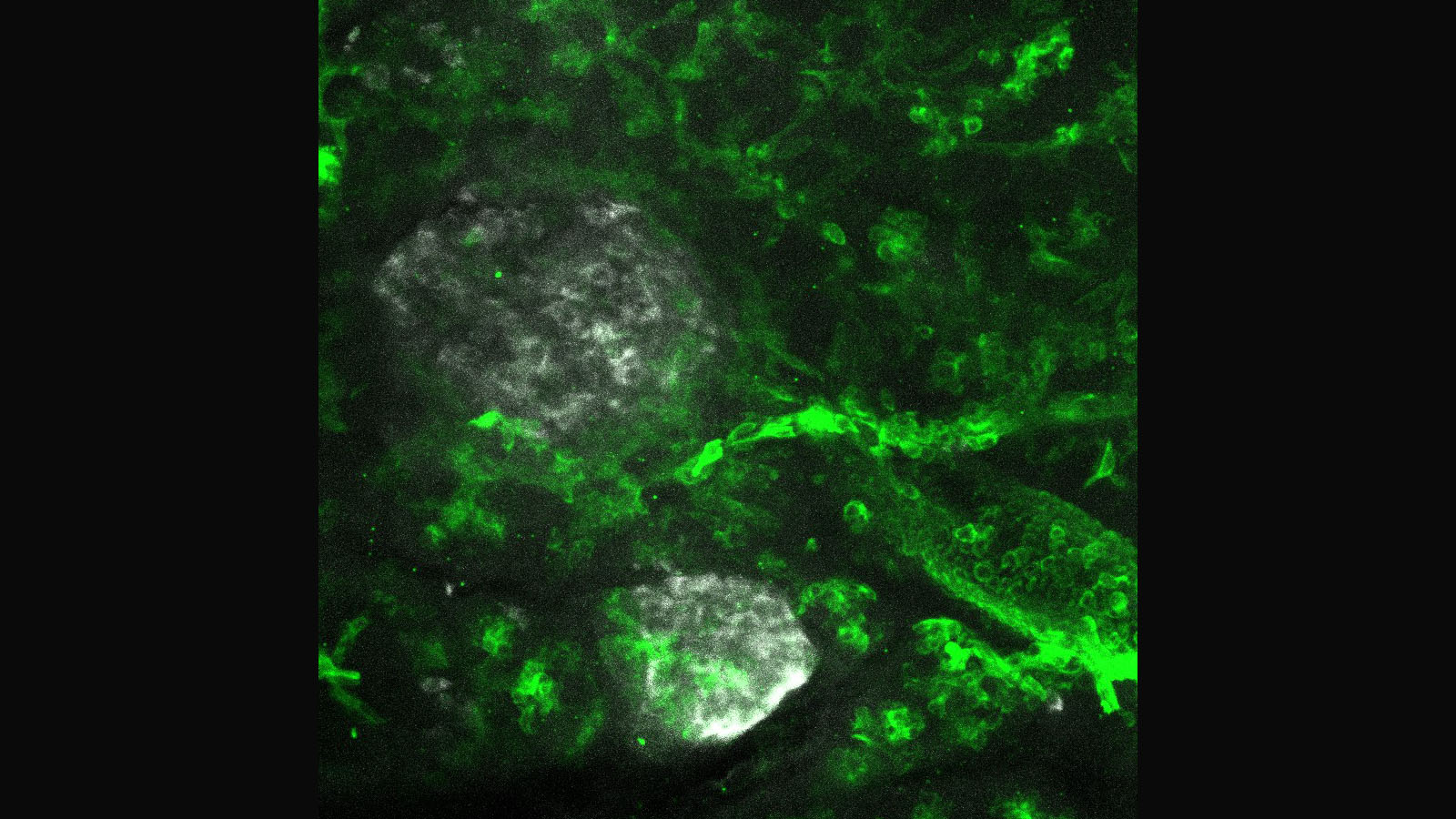 Confocal image of healthy human pancreas from Martha Campbell-Thompson at University of Florida