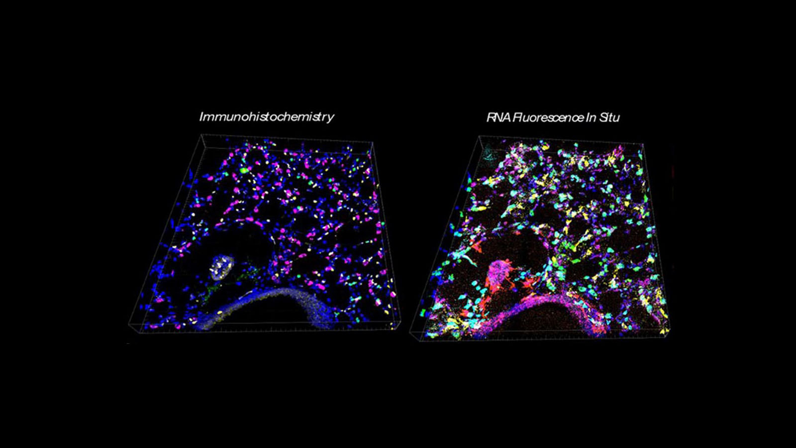 IHC and RNA fluorescence images of mouse lung, courtesy of Peter Chou at Stanford University