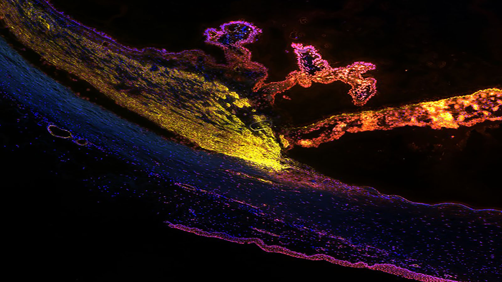 Multiplexed immunofluorescence image of the eye, courtesy of Dr. Angela Kruse of Vanderbilt University