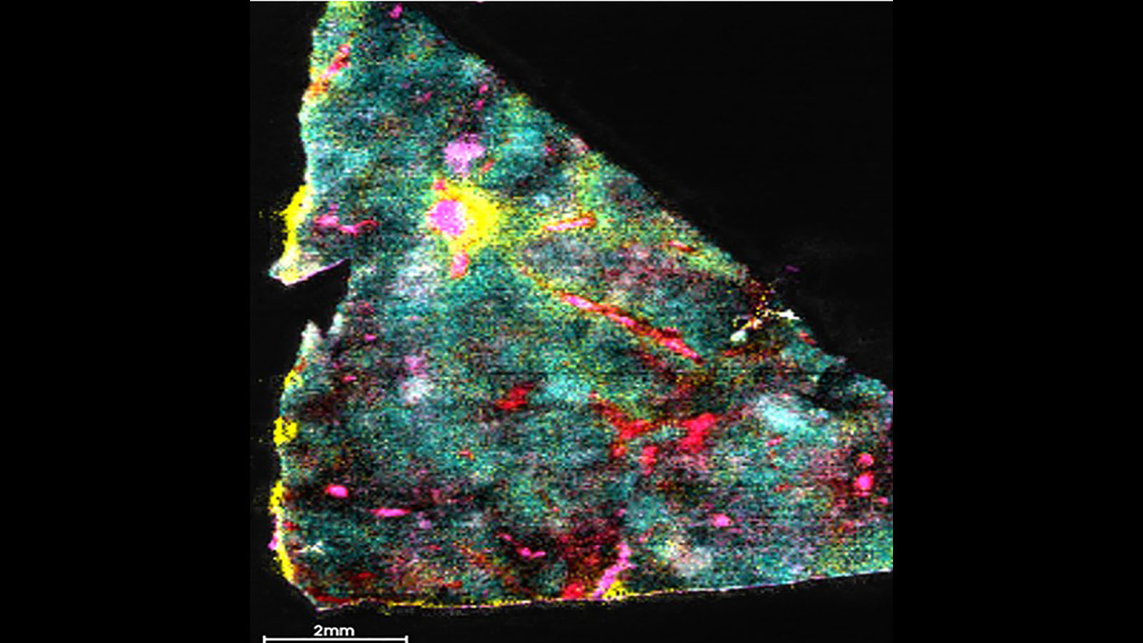 DESI image of lipids within a human liver, courtesy of Dr. Presha Rajbhandari at Columbia University