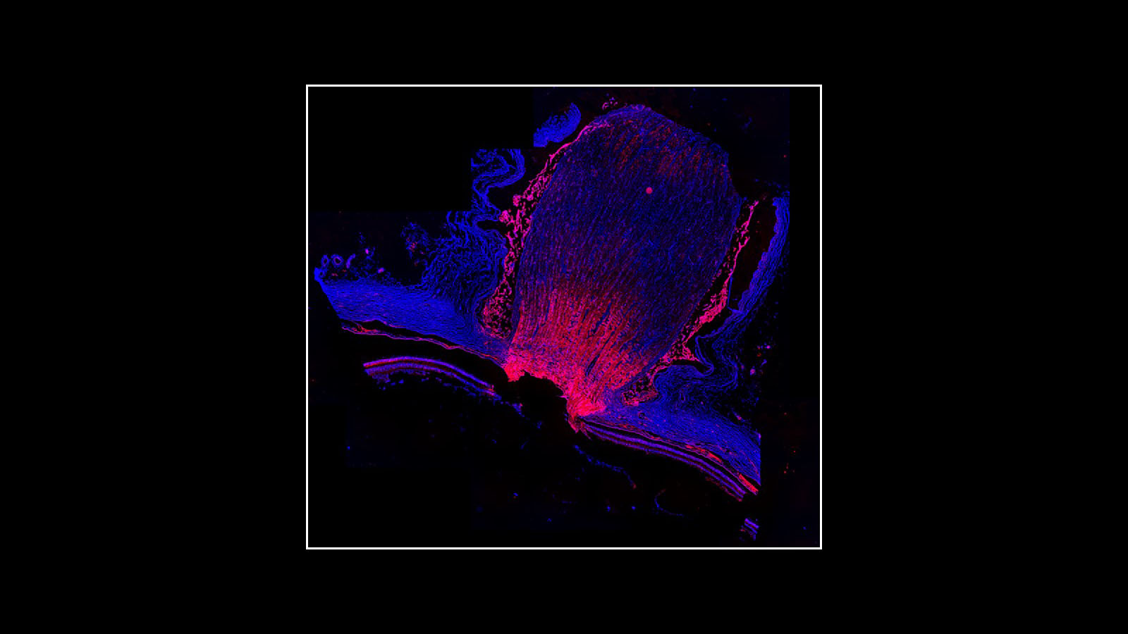 Immunofluorescence image of the human optic nerve, courtesy of Dr. Angela Kruse of Vanderbilt University