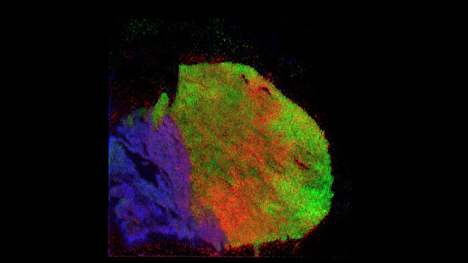 DESI image of mouse heart courtesy of Taruna Neelakantan from Columbia University