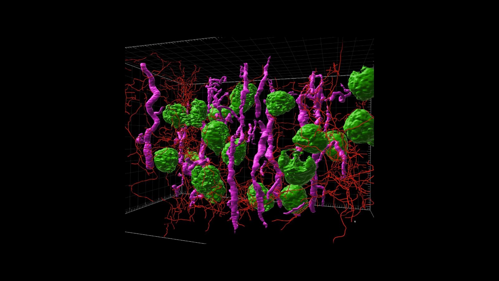 3D rendered light sheet microscopy image from human kidney cortex courtesy of Drs. Praveen Krishnamoorthy, Bo Zhang & Sanjay Jain at Washington University of St. Louis .