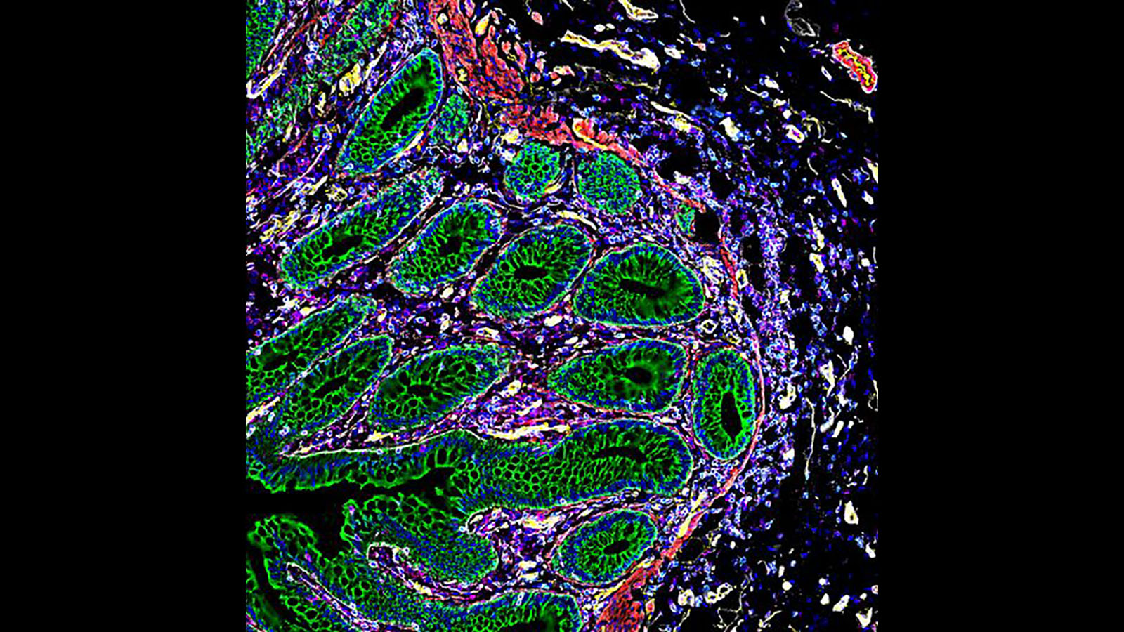 #CODEX image of healthy human intestine courtesy of Dr. John Hickey at the Nolan lab at Stanford University